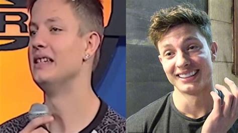 matt rife glow up|matt rife before dental work.